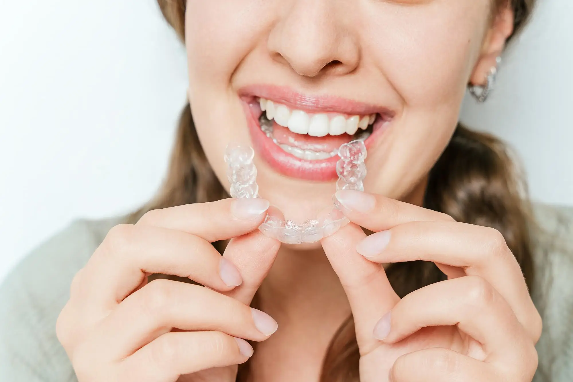 Invisible Braces & Clear Aligners - Smirk Dental
